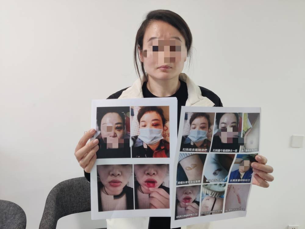 足球波胆
_郑州一女子被企业家丈夫家暴最新进展:已要回孩子抚养权