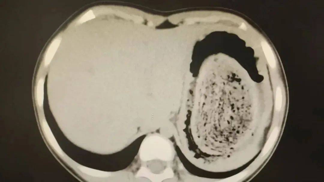 皇冠信用網在线注册_发现一例皇冠信用網在线注册,10岁女孩确诊!已有多起病例,有人因羞耻感延误就医