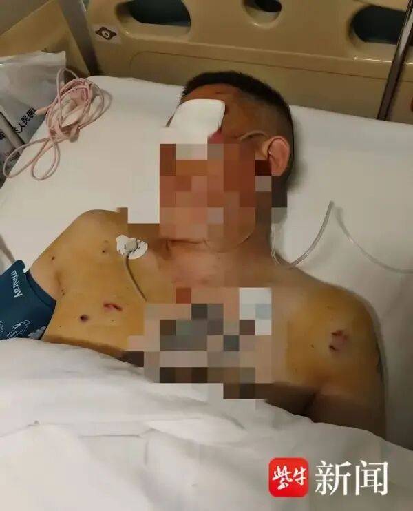 体斯輀必箭v克拉门扞国王_男子取170万元现金银行门口遭抢体斯輀必箭v克拉门扞国王，工作人员无动于衷