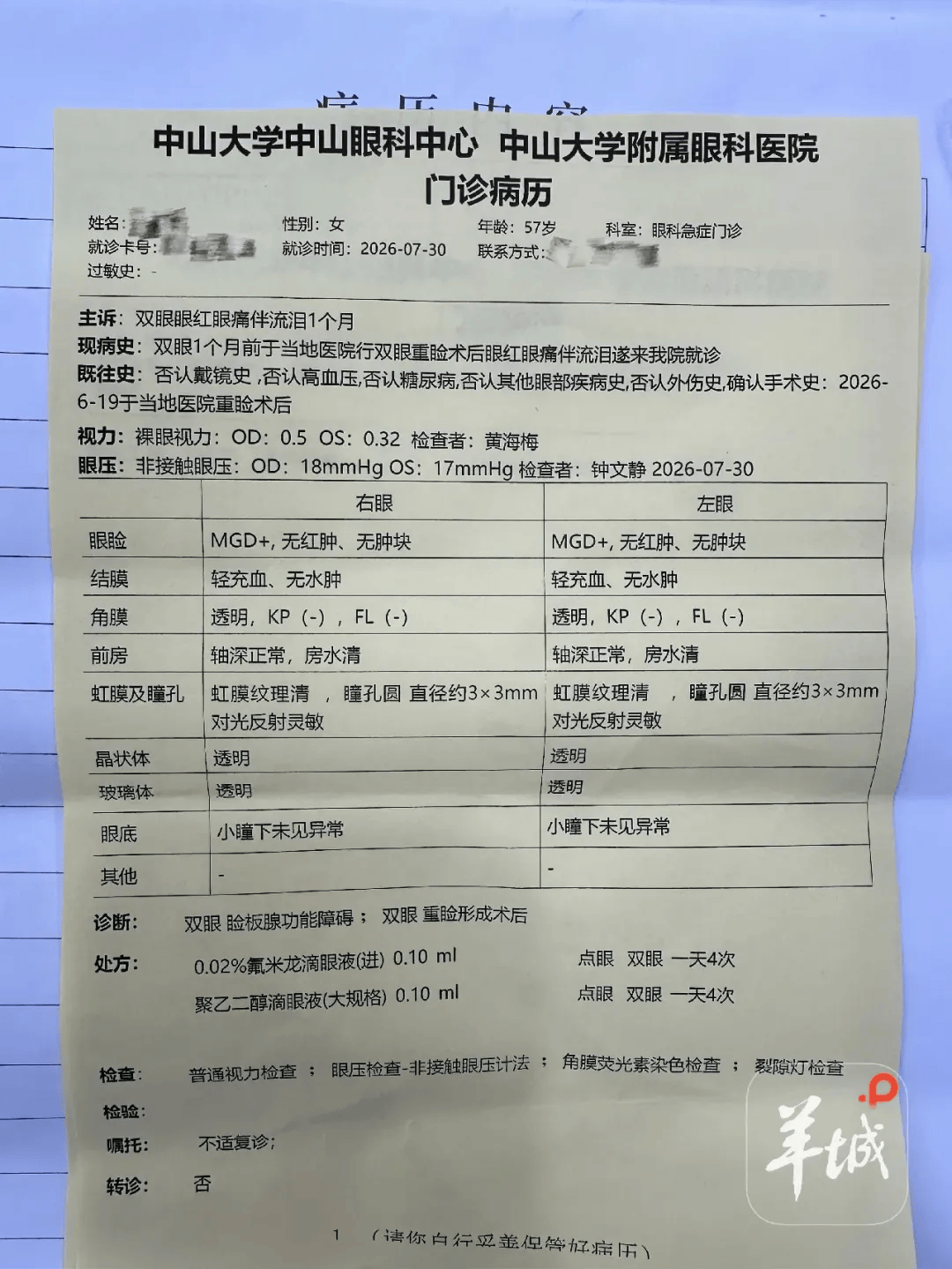 世界杯皇冠信用网代理_从600多元变成5万元世界杯皇冠信用网代理,广东57岁保洁员掏空积蓄做医美,双眼皮手术后眼睛红痛、视物模糊,当事人:销售像人贩子一样围着我;机构拒绝回应